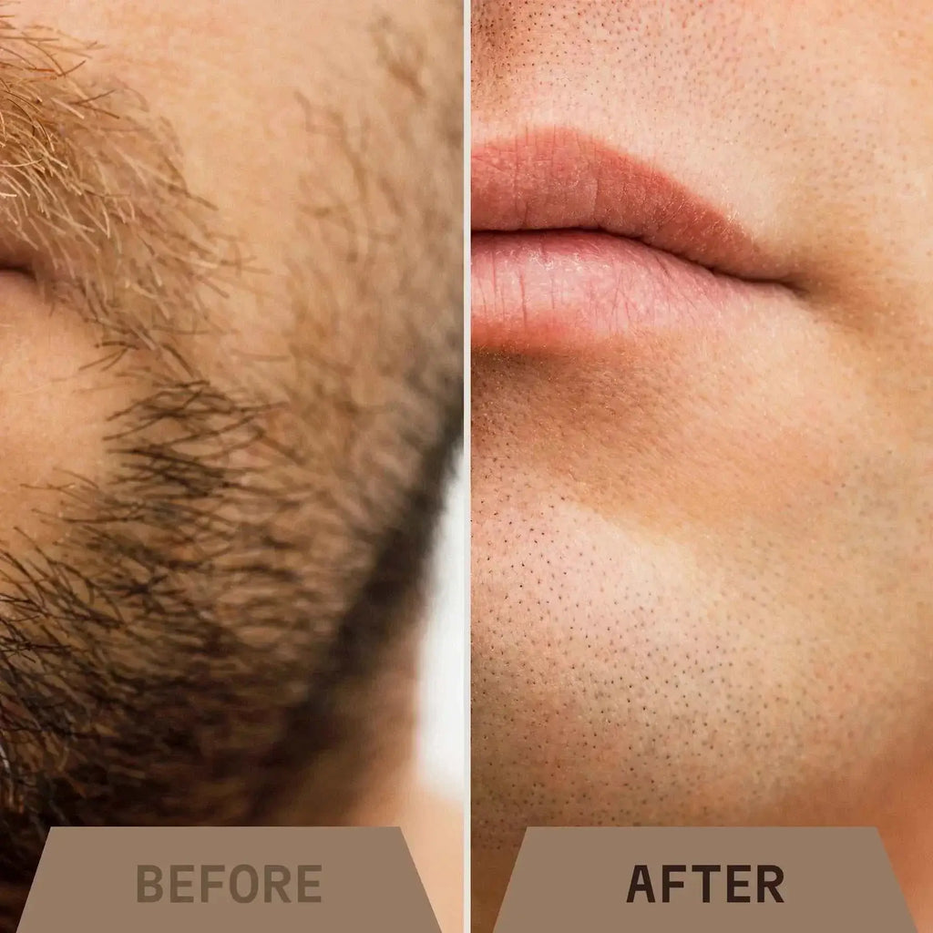 Before and after skin results using After Shave Balm for Men with sandalwood, showing a smoother complexion.