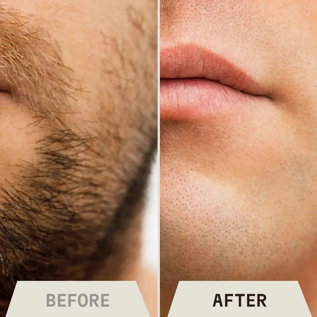 Close-up comparison of a man's face before and after using unscented shaving cream, highlighting smooth skin results.